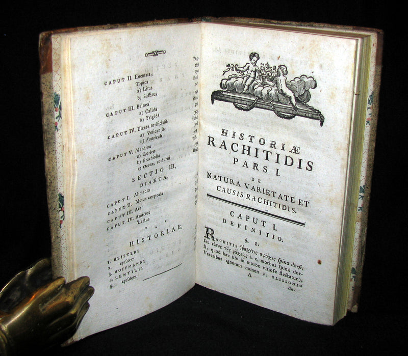 1787 Rare Medical 1stED Book on RICKETS - HISTORIA RACHITIDIS by Trnka de Krzowitz